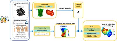 Electrocardiographic Imaging for Atrial Fibrillation: A Perspective From Computer Models and Animal Experiments to Clinical Value